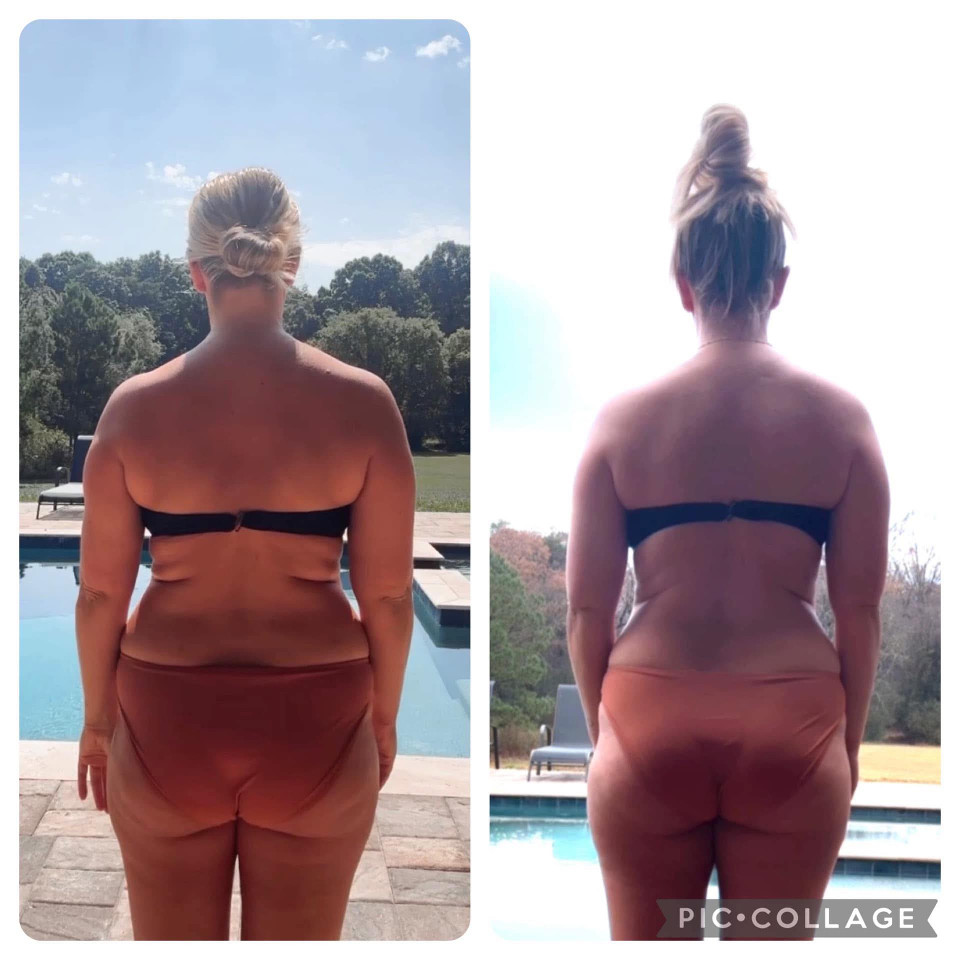 Hurray for Heather! My friend had this to say about her bioactive peptide journey. 

Holy BACK FAT y’all! 🙃🙃🙃

Not a side or me I ever wanted to share with the world, but I know it’s gonna help so many of you!

Check out my 30 day progress after starting with these peptides.  I love that you don’t have to give yourself a shot, that they are all natural and affordable. 

Before starting these I already ate a clean / high protein diet and exercised 5-6 times a week, so nothing really changed there.  Adding in these peptides has just helped my body just work better. 

Check the comments for an update. 

DM me INFO to learn more about what she’s using. 🧬